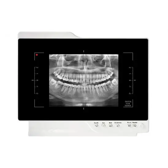 Câmera intraoral imagem 4